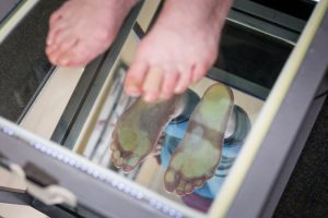 Custom Orthotics. Digital foot scan of feet.