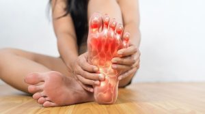 Pedorthic Clinic. Painful and inflamed gout on foot. A woman with red feet is sitting on the floor. She is holding her feet and rubbing them.