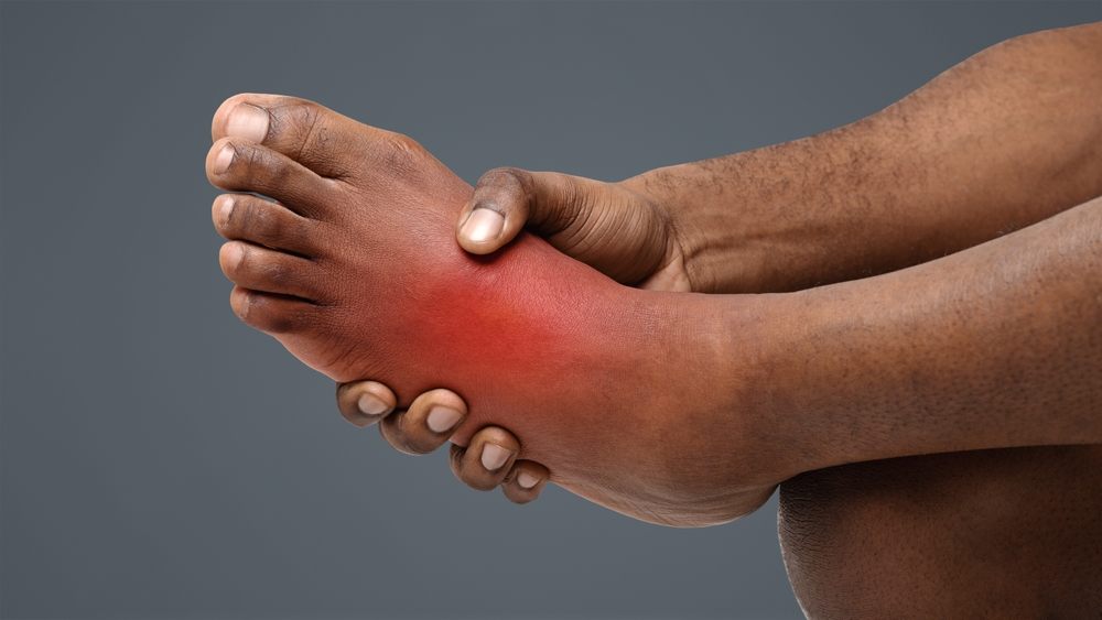 What Are Custom Orthotics? Cropped of black man holding his painful foot, cramp, muscular spasm, red accent on sore zone.