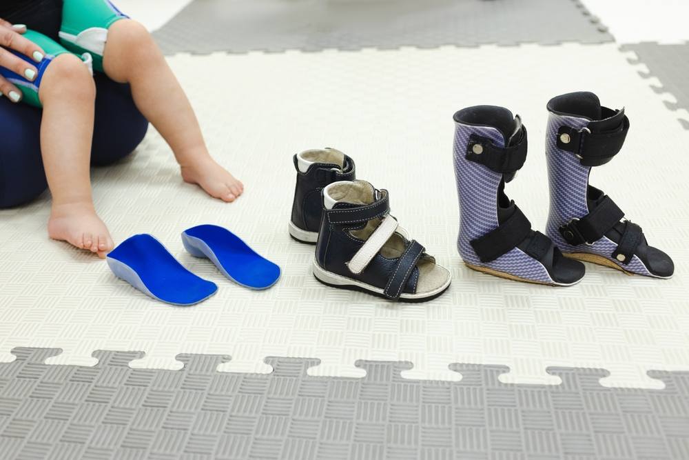 How to Choose the Best Orthopedic Shoes for Specific Foot Conditions. Selection of the right orthopedic shoes or orthoses for a child with valgus deformity of the feet in a rehabilitation center. Orthopedic shoes for the treatment of foot deformities.